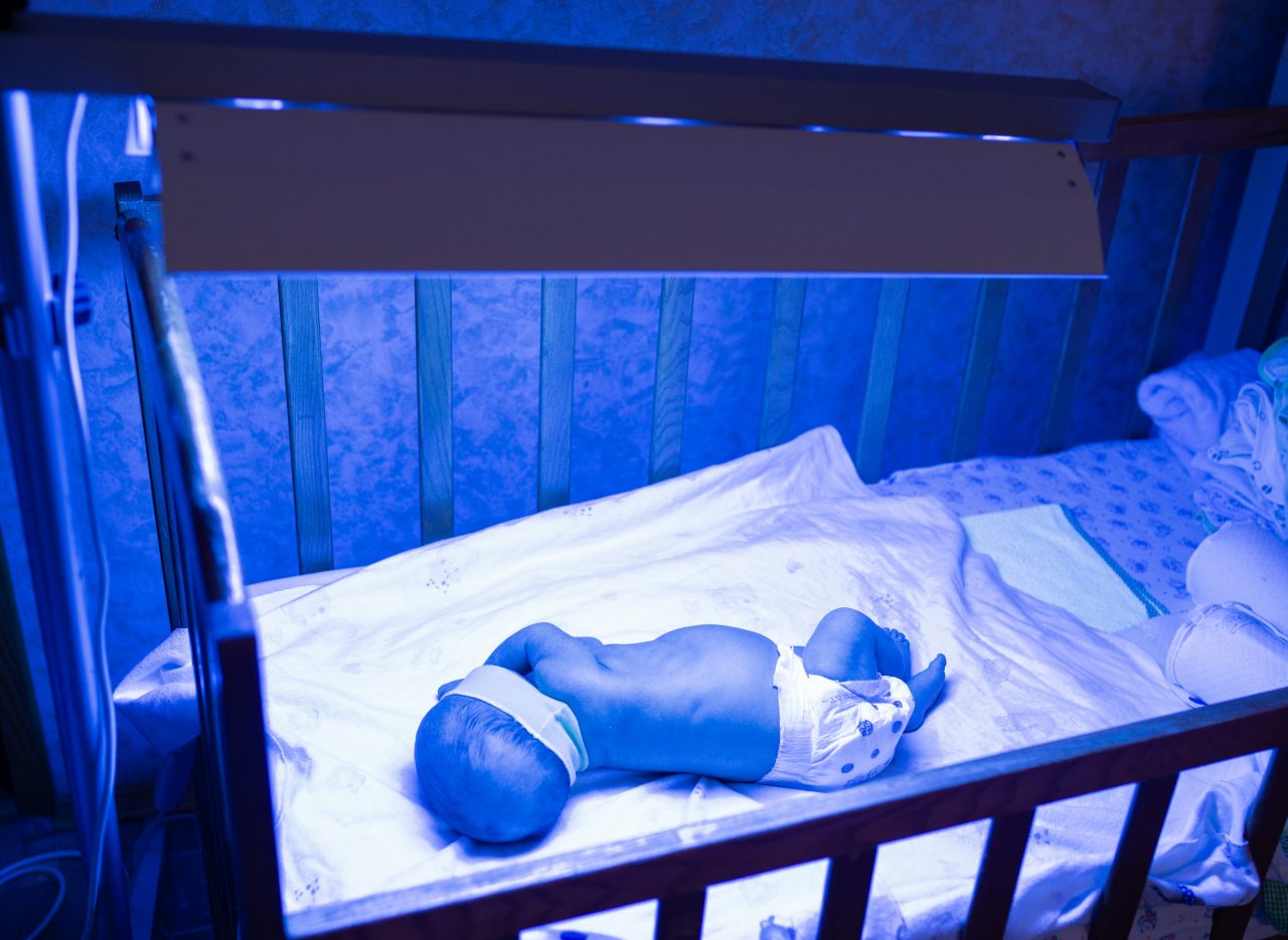 newborn-having-a-treatment-for-jaundice-under-ultr-2021-09-04-03-50-47-utc-1280x935.jpg